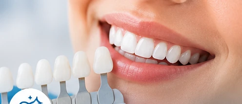 Teeth Whitening
